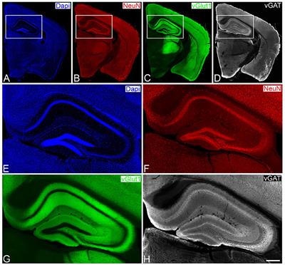 MultiMap: A Tool to Automatically Extract and Analyse Spatial Microscopic Data From Large Stacks of Confocal Microscopy Images